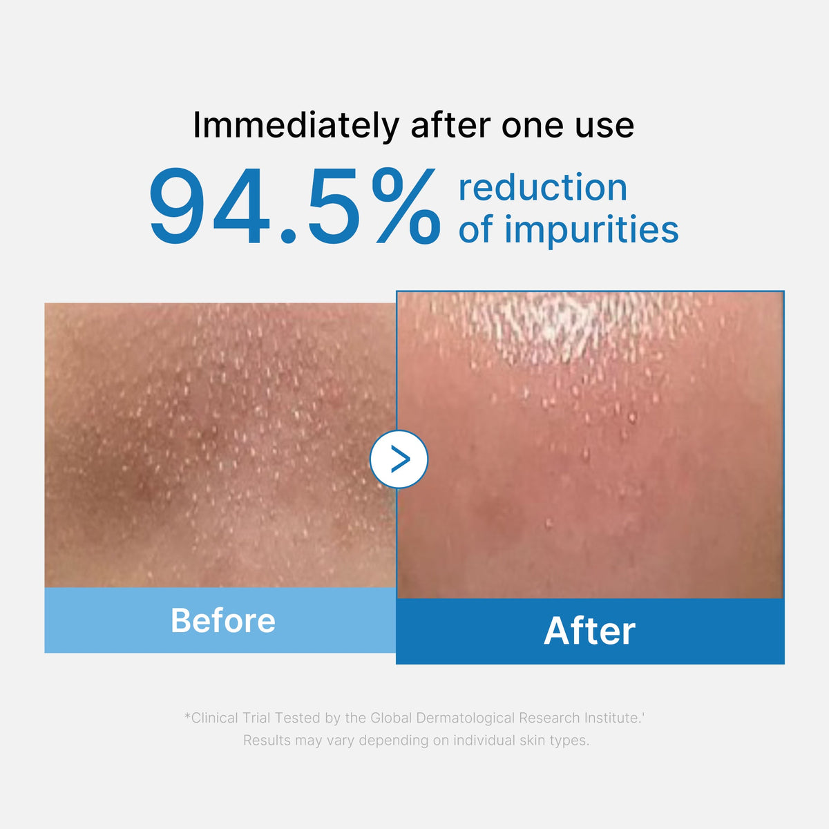 Zero Pore Blackhead Deep Cleansing Oil B9