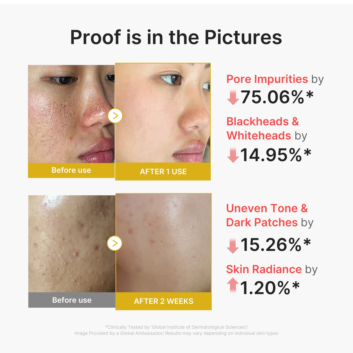 Kojic Acid Turmeric Peel Shot V7