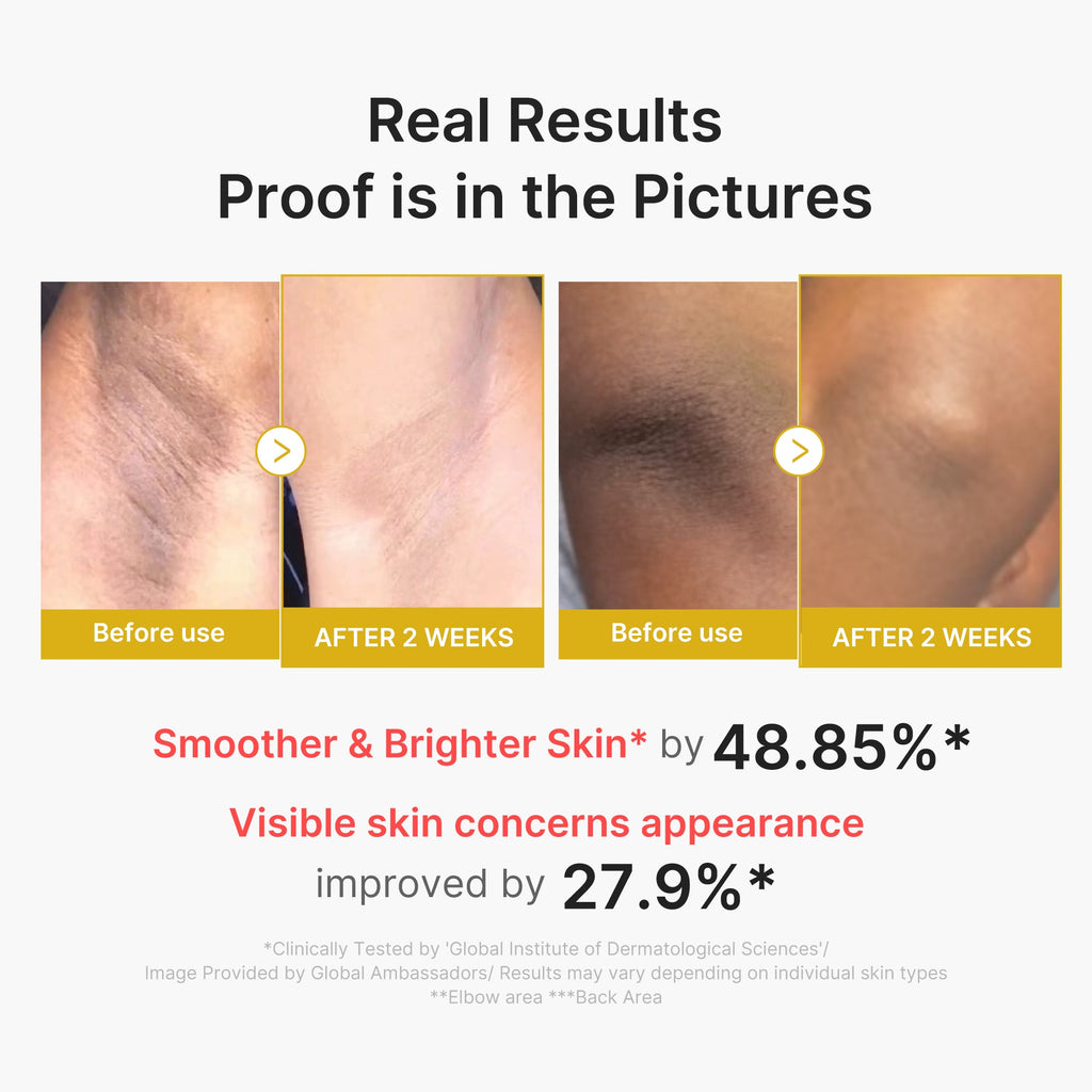 Kojic Acid Turmeric Body Peel Shot Z8
