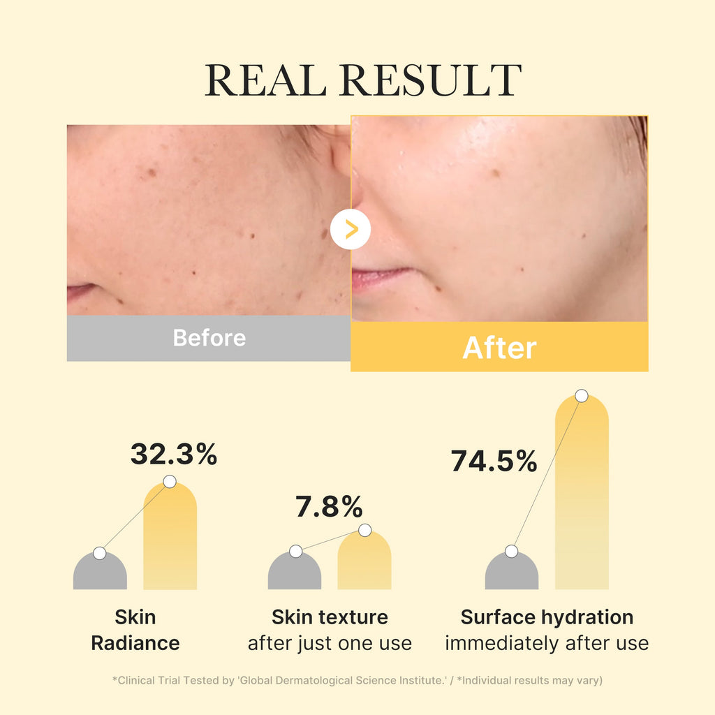 Kojic Acid Turmeric Gold Jelly Gel Mask W4