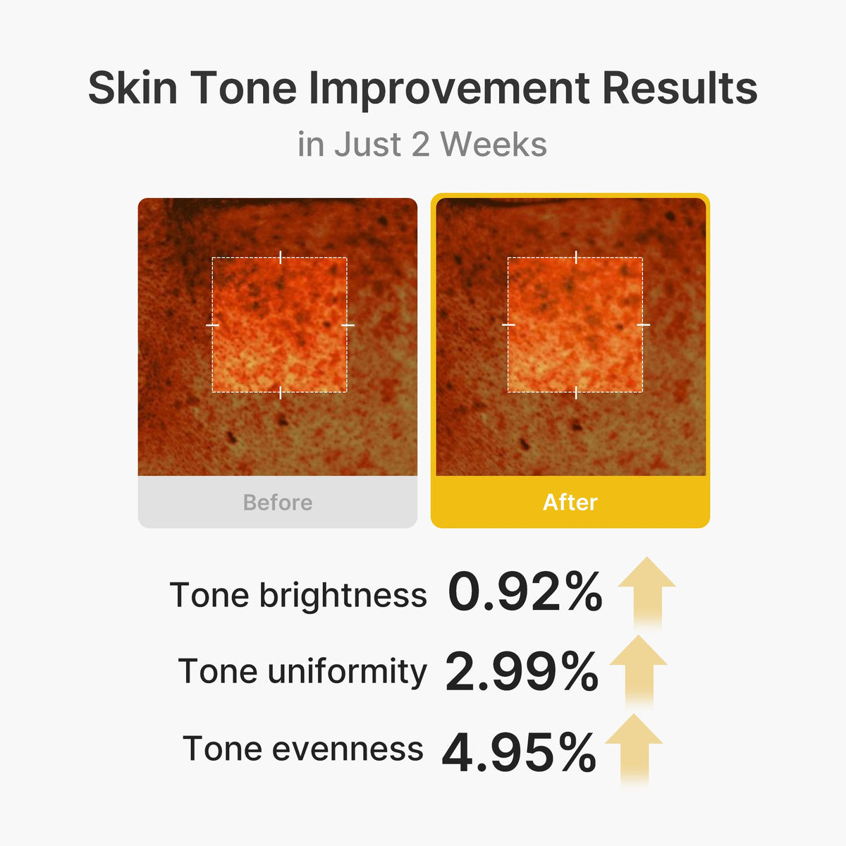 Kojic Acid Turmeric Vita Capsule Cream N7