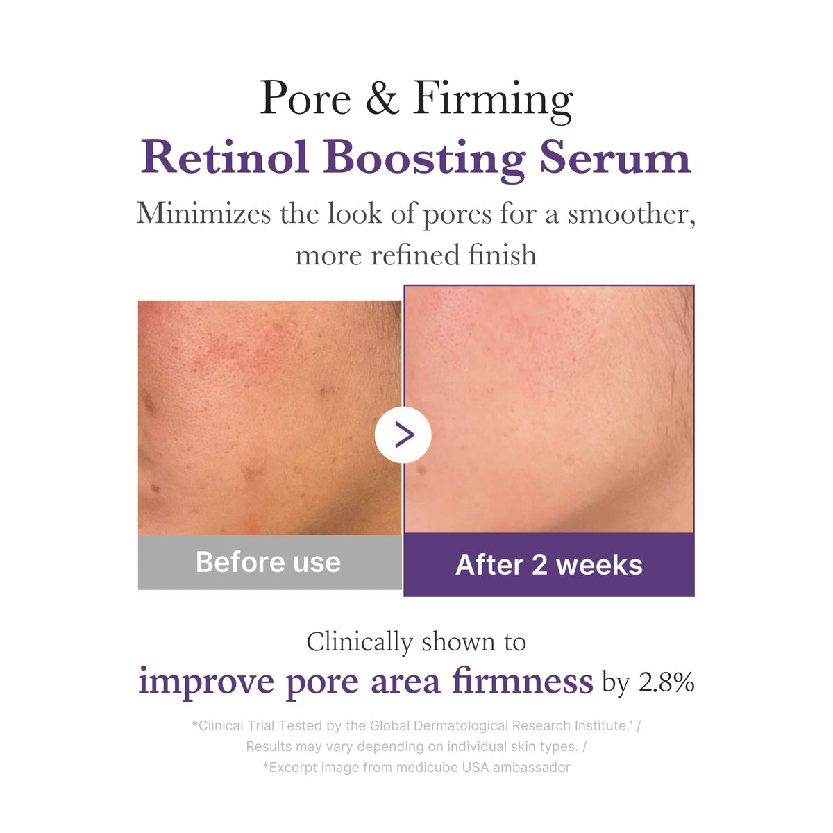 Retinol NMN Boosting Serum M9