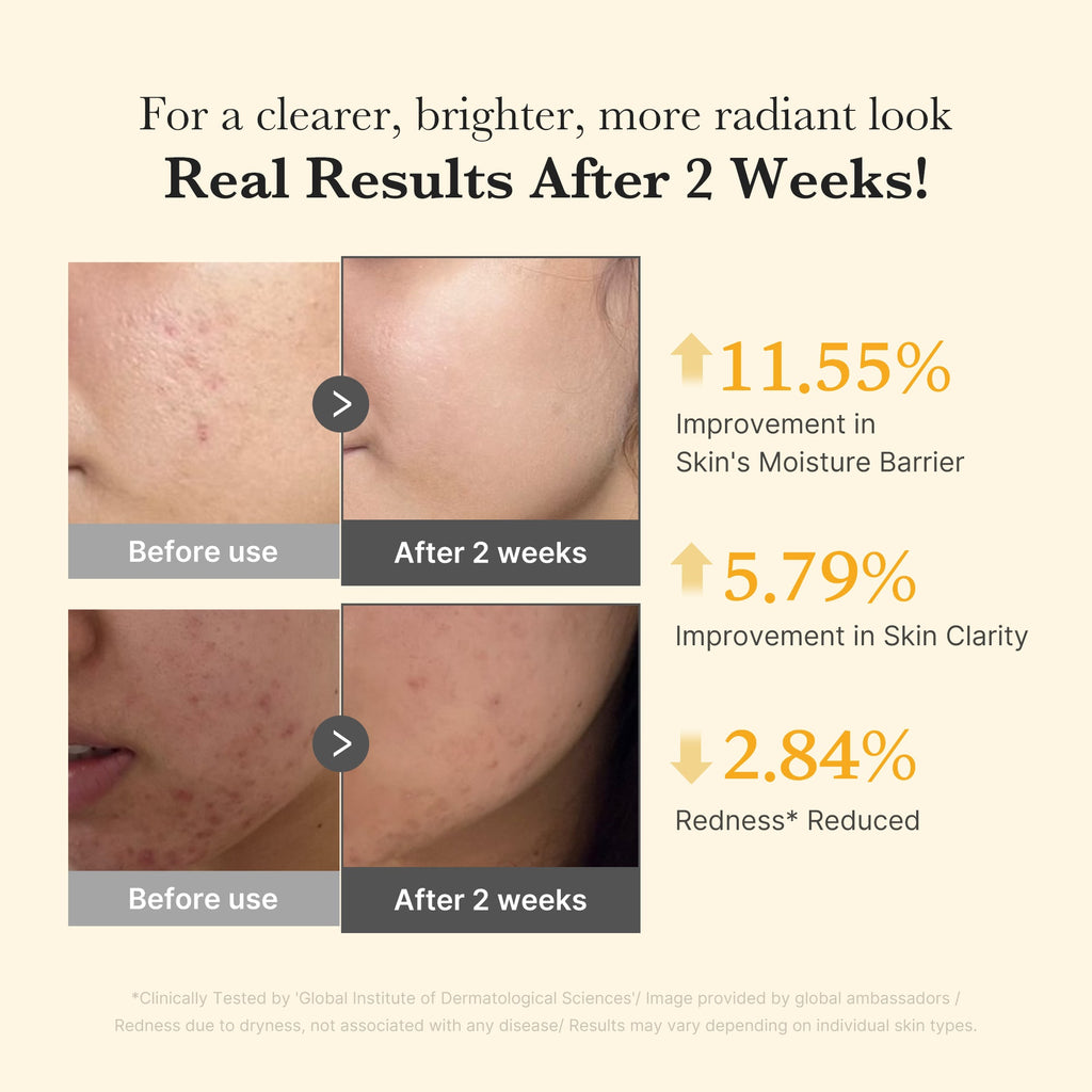 Kojic Acid Turmeric Capsule Serum Y2