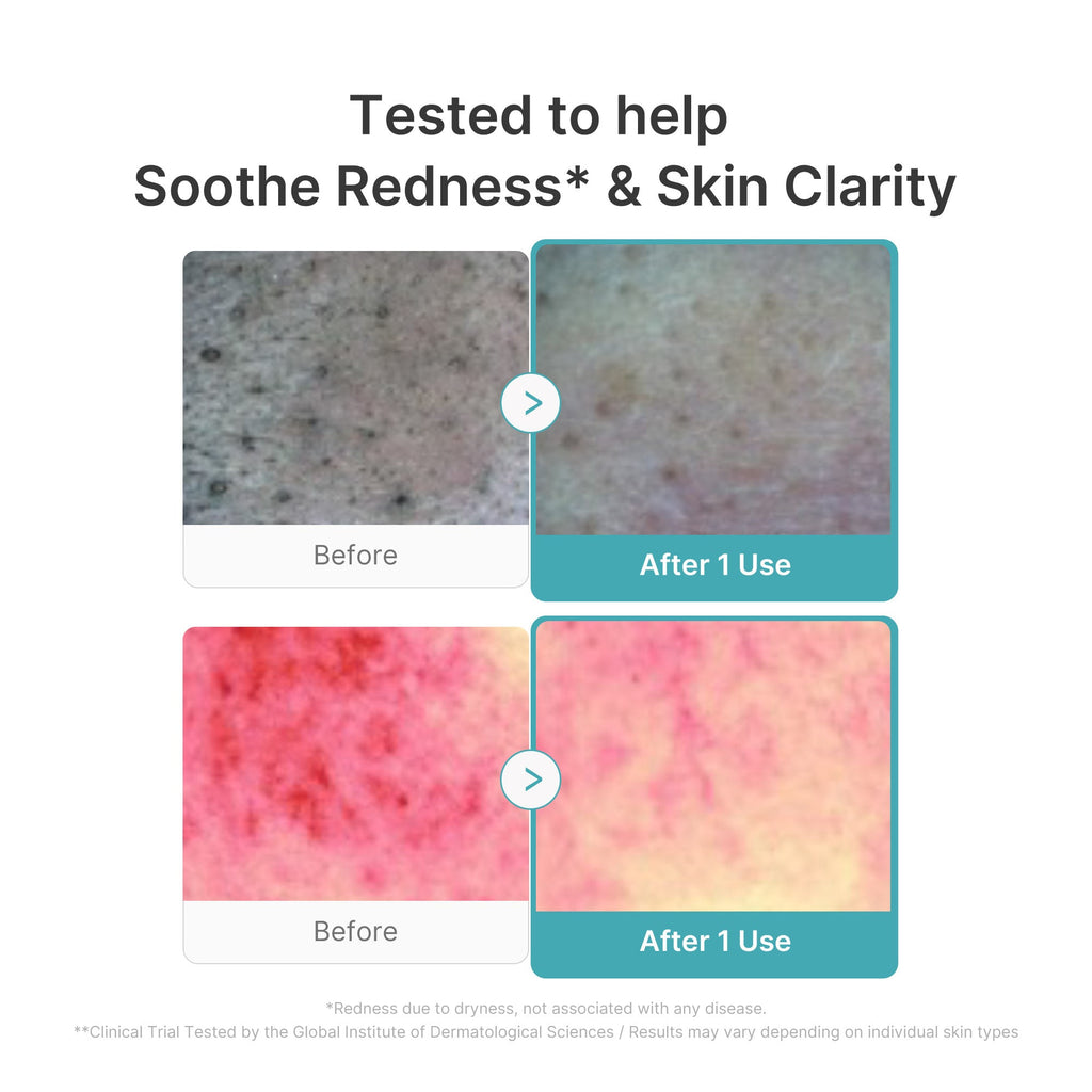 Azelaic Acid Capsule Foam Cleanser O7