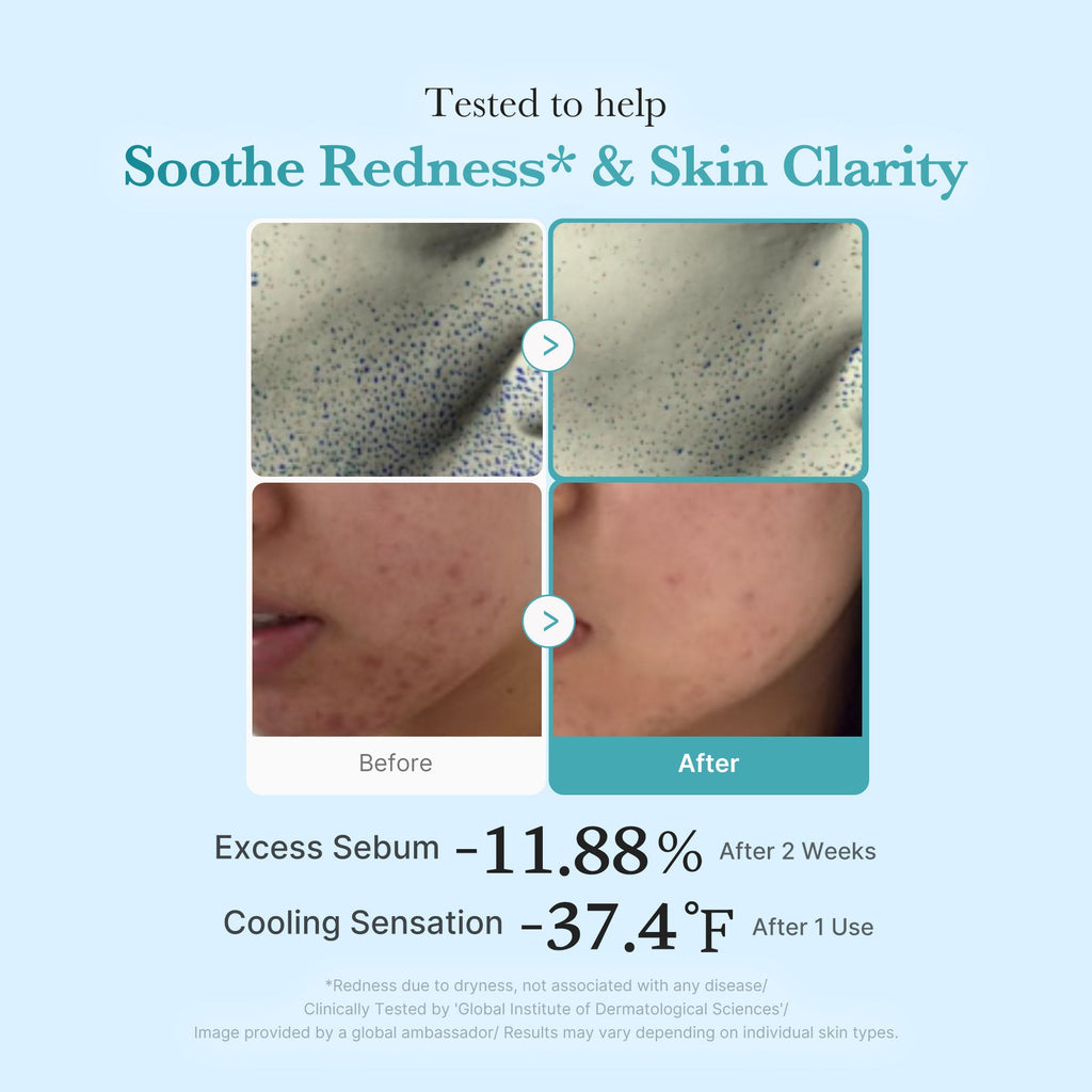 Azelaic Acid Niacinamide Clarifying Toner R3