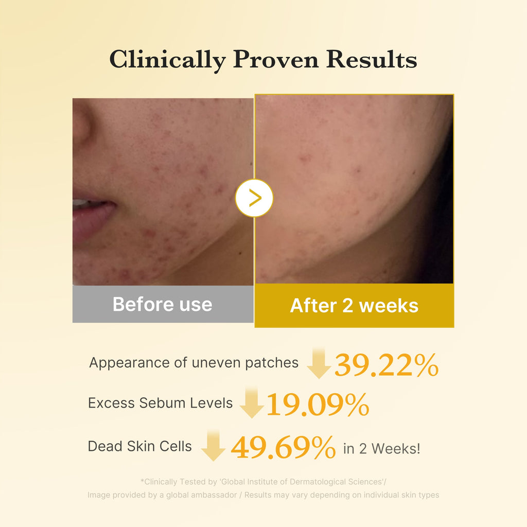 Kojic Acid Tumeric Toner Pad O0