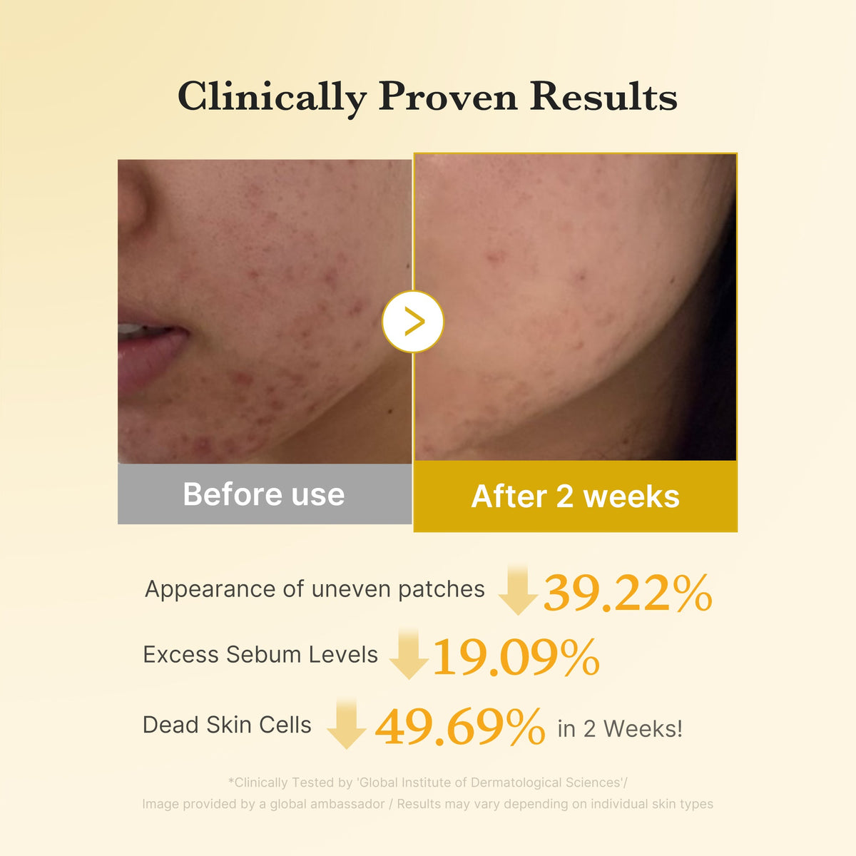 Kojic Acid Tumeric Toner Pad O0