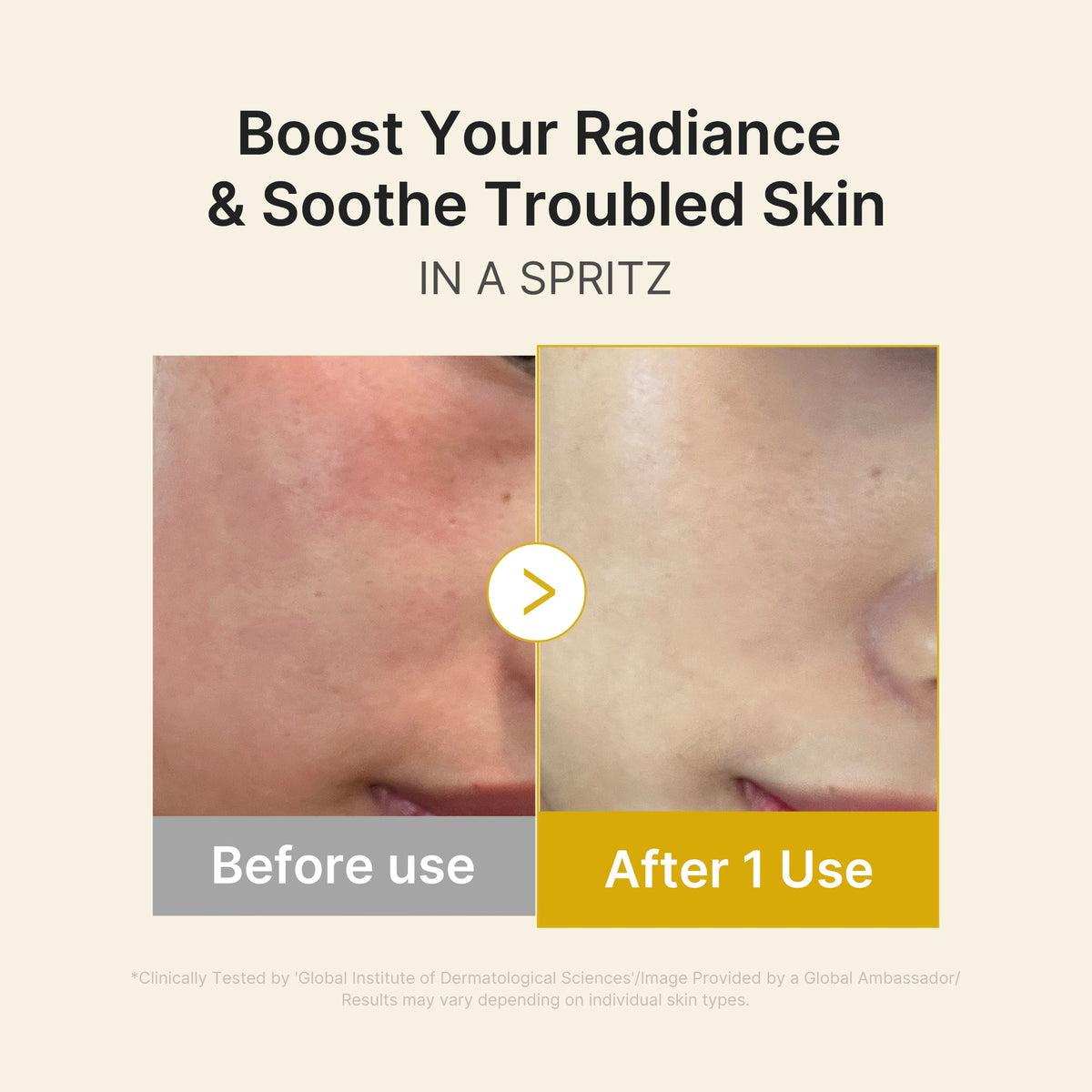 Kojic Acid Turmeric Vitamin Gold Jelly Mist Serum H7