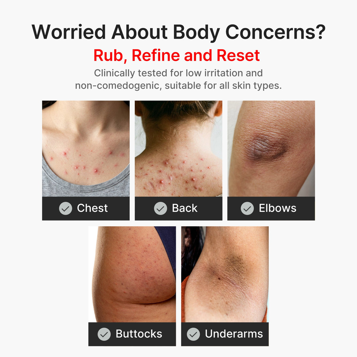 Kojic Acid Turmeric Body Peel Shot Z8