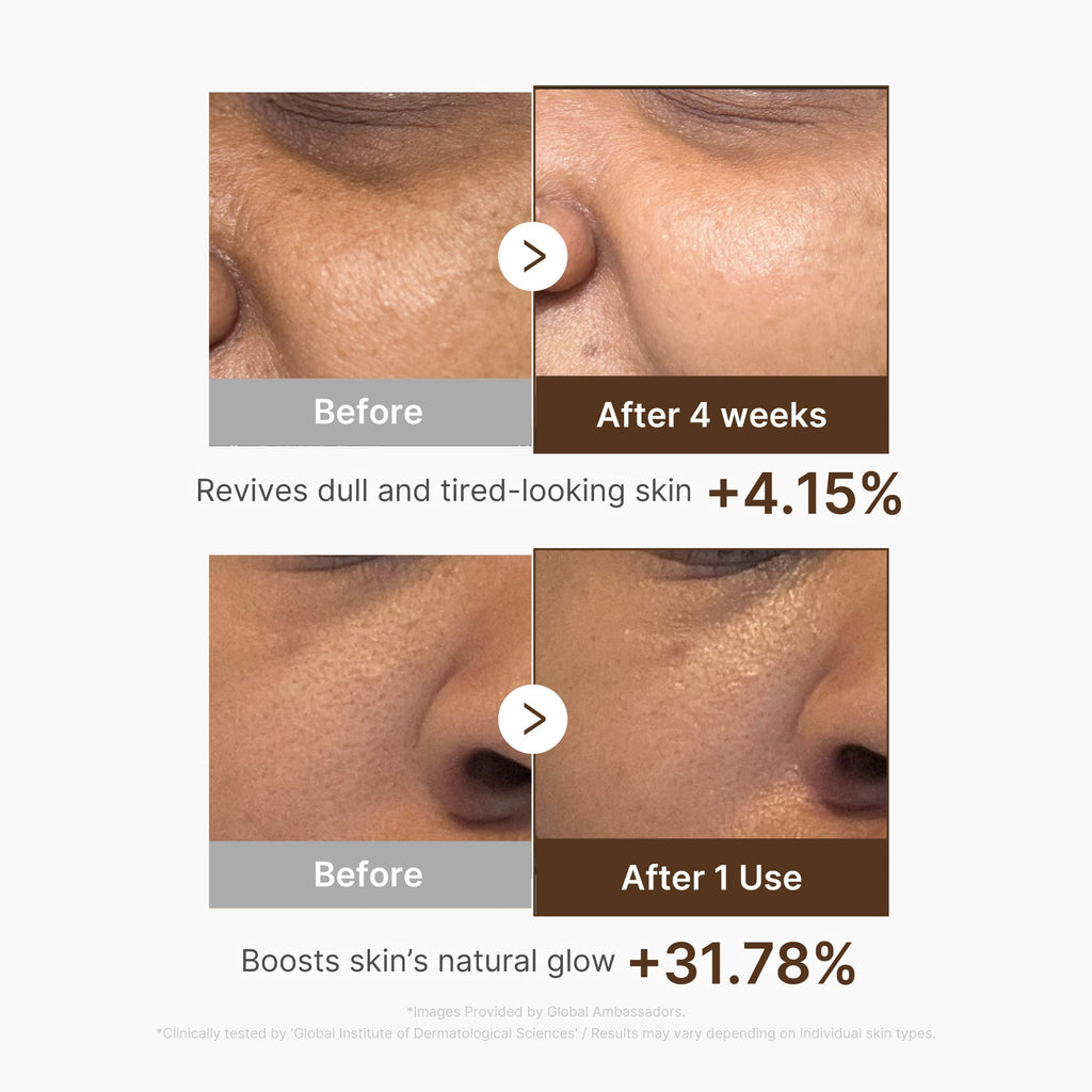 Deep Vitamin C Capsule Serum V9