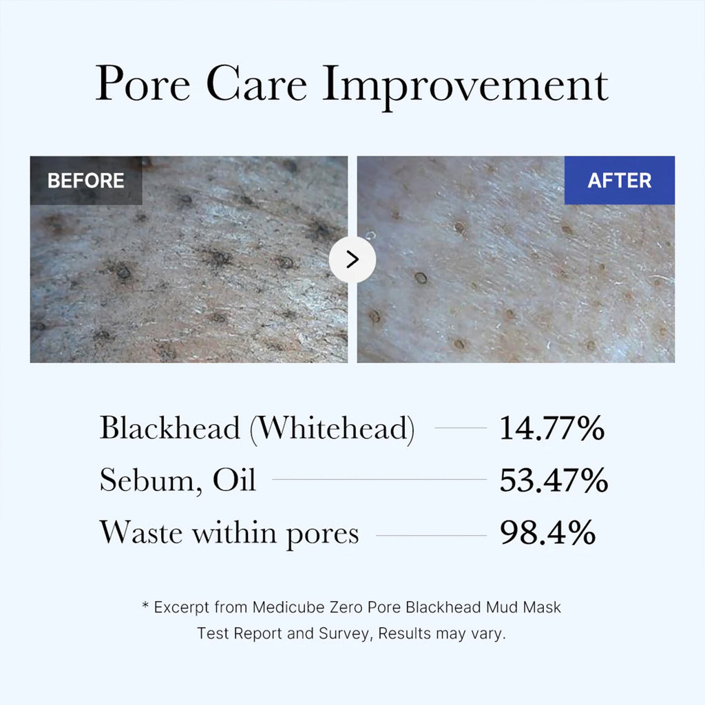 Zero Pore Blackhead Mud Mask R0
