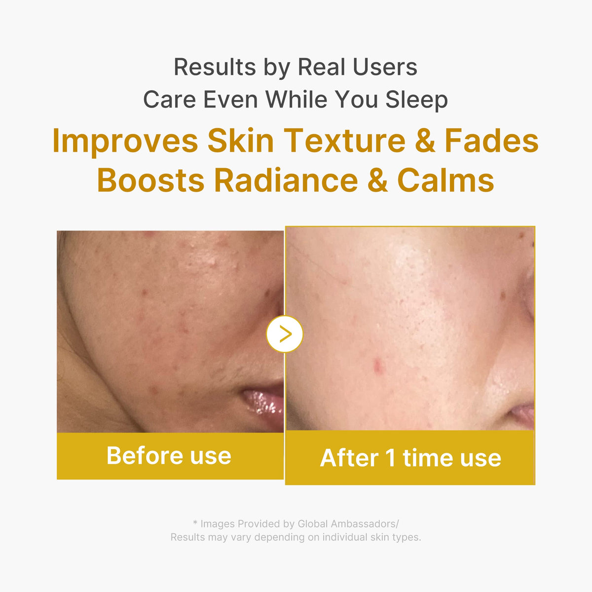 Kojic Acid Turmeric Overnight Wrapping Mask X2