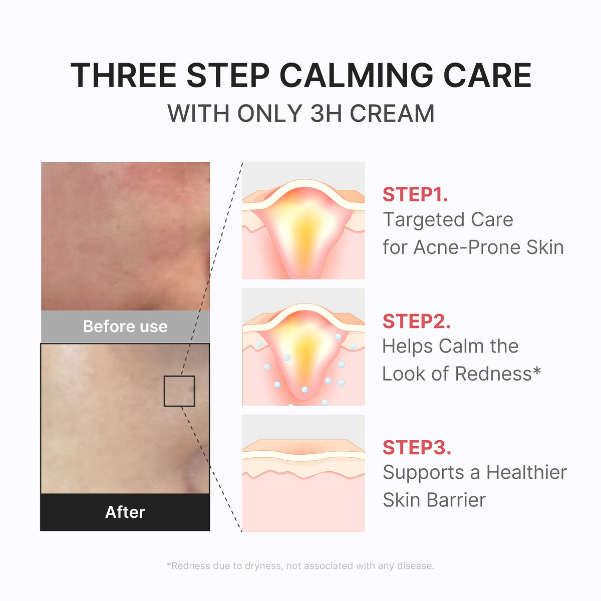 3H Daily Relief Cream S5