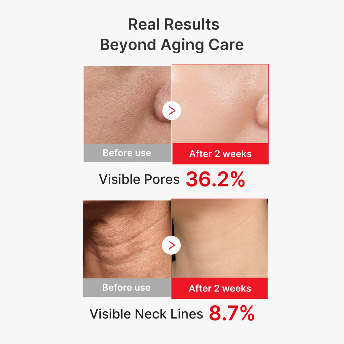 EGF NAD+ Firming Serum E0