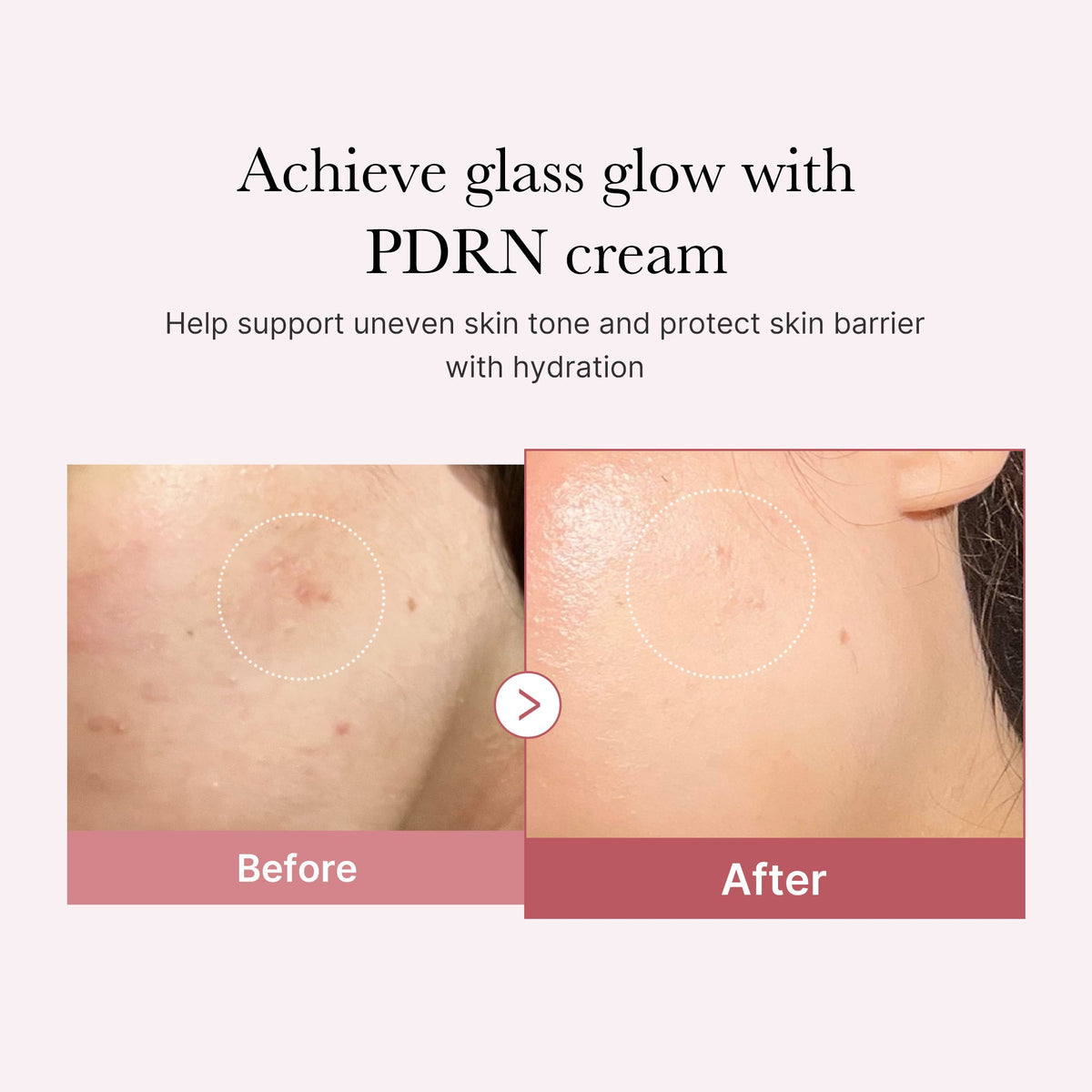 PDRN Pink Peptide Cream E9