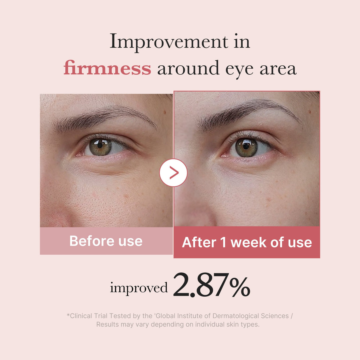 PDRN Pink Peptide Eye Cream N9