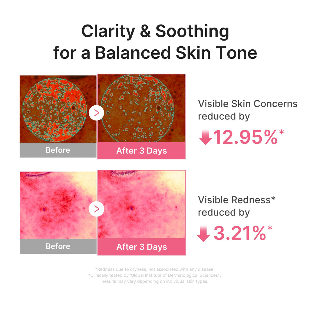 Ultra Light PDRN Pink Peptide Serum P5