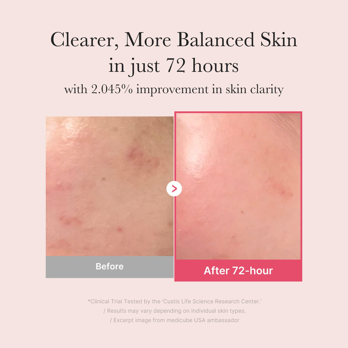 TXA Niacinamide Serum Z6