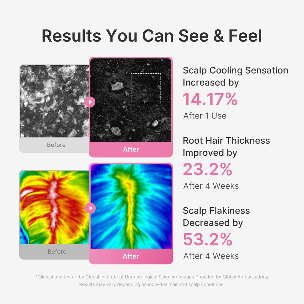 Rosemary PDRN Scalp Serum M0