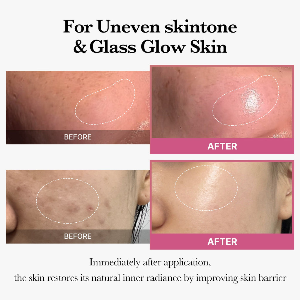 [Tati's Exclusive] All About Glow Set D3
